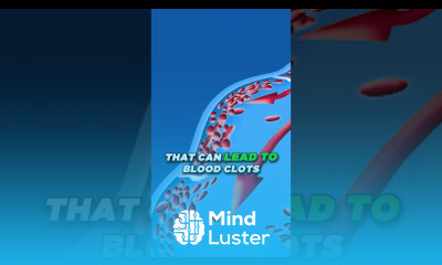 Vein Stasis Dermatitis Lymphedema Varicose Veins Causes Stages