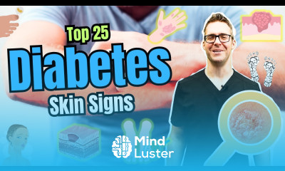 Top 25 Skin Signs Symptoms of Diabetes Type 2 Diabetes Early Signs