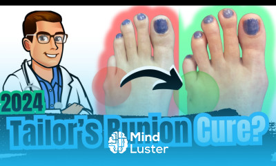 Bunionette Tailor s Bunion Surgery Corrector Splints Treatment