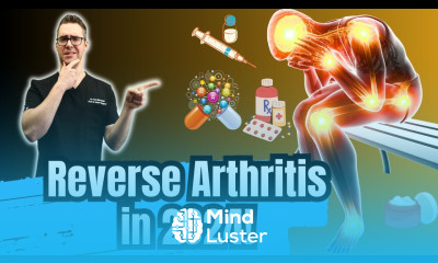 Top 10 New Arthritis Treatments Osteoarthritis Rheumatoid