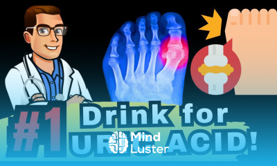 TOP 5 Drinks to Reverse High URIC ACID GOUT
