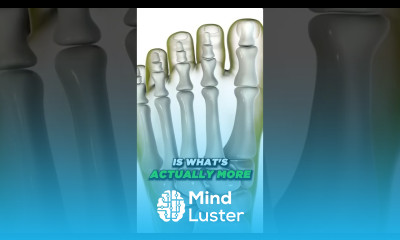 Do Bunion Correctors Work How to shrink bunions naturally