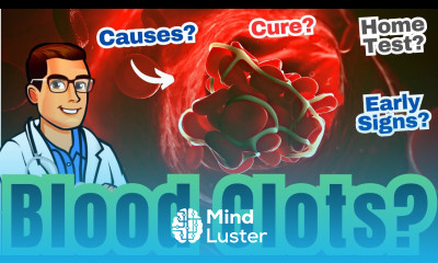 Blood Clot in the Leg Early signs Symptoms How to Check Causes