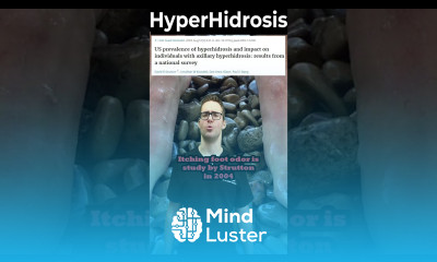 How To Stop Sweaty Feet Palms Hyperhidrosis Treatment