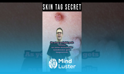 How To FIX Skin Tags FOREVER