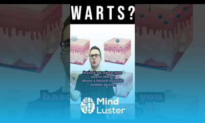 Plantar Wart Removal How to Identify a wart Treat It