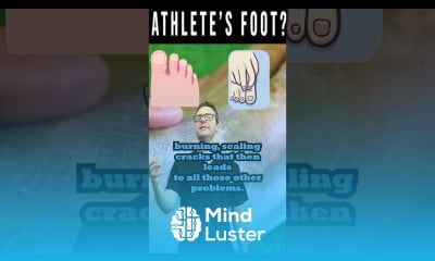 Athlete s Foot Fungus The Itchy Scaly Truth