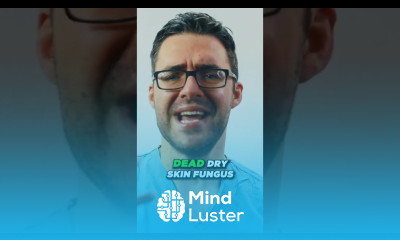 Prevention TIPS for ATHLETE S FOOT How LONG Powders Lamisil Foam Sprays Moisturize