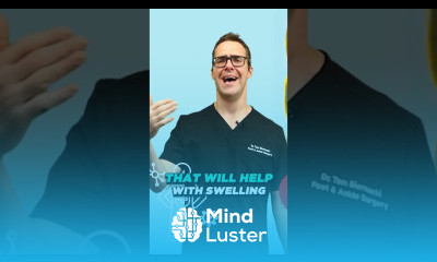 Varicose Vein Natural Treatment FIX Spider VEINS