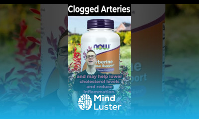 Berberine Benefits Weight Loss Supplements Side Effects