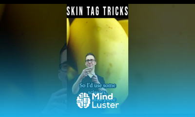 Skin Tag Removal Wart Removal Natural Remedy Banana Peel Trick