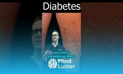 Diabetic Dermopathy Pictures Treatment Diabetes Symptoms Signs