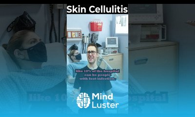 Red Hot And Itchy The Signs You Have Cellulitis