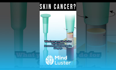 Skin Cancer Don t Ignore The Warning Signs