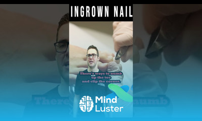 Ingrown Toenail Self Care Home Treatment