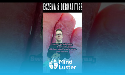 Dermatitis Eczema Dry Itchy Skin or Rash not Better