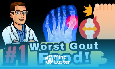 The 1 Worst Gout Food I m Sorry