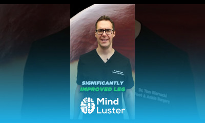 How to prevent varicose veins Naturally STOP Spider Veins