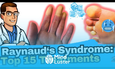 Raynaud s Syndrome vs Phenomenon vs Disease Why Are My Toes Cold