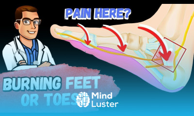 Burning Tingling Numbness in Feet Legs Tarsal Tunnel Syndrome