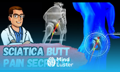 How To Cure Sciatica Permanently Treatment Stretches Exercises