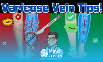 Best Varicose Vein Home Treatments Top 25 Spider Veins Remedies