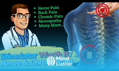 Spinal Cord Stimulator for Chronic Pain Neuropathy Back Pain