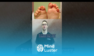 Raynaud s Syndrome When Your Toes Hands or Feet Turn Red or White