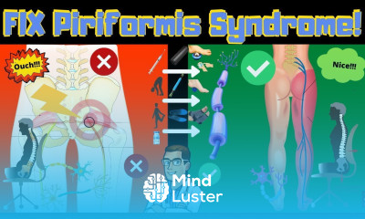 Piriformis Syndrome Won t Go Away Stretches I Exercises I Treatment