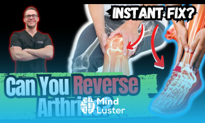 BEST 5 Ways to STOP Arthritis Pain Big 2023 New SECRETS