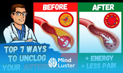 REVERSE Your Clogged Stiff Arteries 50 Atherosclerosis over 45