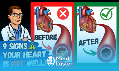 9 Signs You Have Clogged Arteries Heart Problems 7 Treatments