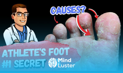BEST Athlete s Foot Fungus Treatments HOME Remedies 3 BIG SECRETS