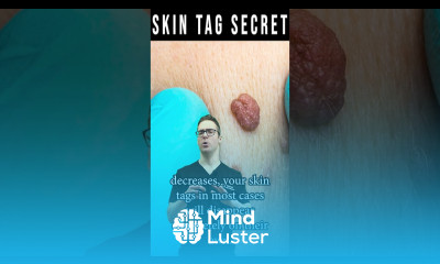 How To Remove Skin Tags FOREVER Skin Tag Removal Secret