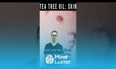Skin Tag Removal Wart Removal Tea Tree Oil Natural Remedy