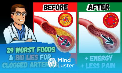 29 WORST Heart Artery Foods To Avoid  REVERSE Clogged Arteries