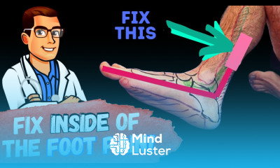 Posterior Tibial Tendonitis Treatment Inside of the Ankle Pain 2022