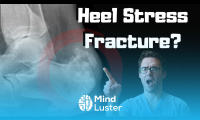 Calcaneus Heel Stress Fracture Treatment Squeeze Test Recovery