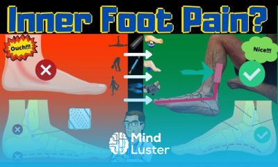 Posterior Tibial Tendonitis Treatment FIX Inside of the Ankle Pain