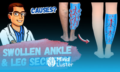 STOP Swollen Ankles Swollen Feet Treatment SECRETS 2024