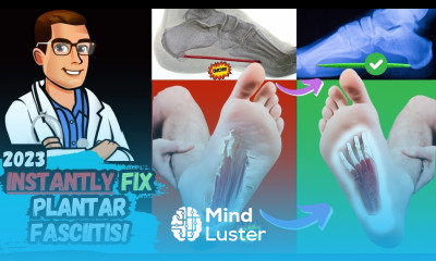 How To Cure Plantar Fasciitis FAST FOREVER Heel Pain Heel Spurs