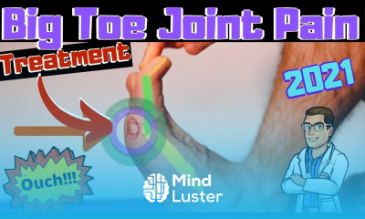 BEST Sesamoiditis Treatment Big Toe Joint Pain Big Toe Treatment