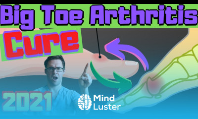 Stiff Big Toe Joint Pain Hallux Rigidus TREATMENT Exercises Taping