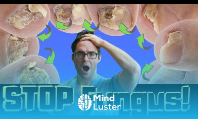 How to CURE Yellow Toenail Fungus Toe Fungus Remedies Treatment