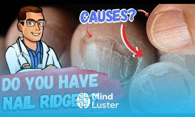 Do you have Vertical Nail Ridges Causes Treatment 