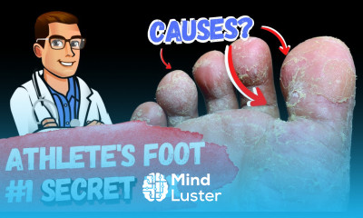 BEST 9 Athlete s Foot Fungus Remedies the 1 Big Mistake 