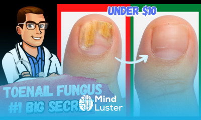 Best Toe Nail Fungus Treatments Onychomycosis Remedies