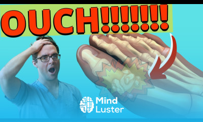 How to Cure Gout in Feet Big Toe Top 11 Gout Remedies Treatments