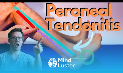 Peroneal Tendonitis Treatment 2024 Peroneus Brevis Longus Pain