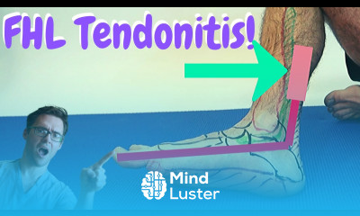 Flexor Hallucis Longus PAIN FHL Tendonitis BEST Treatment 2022